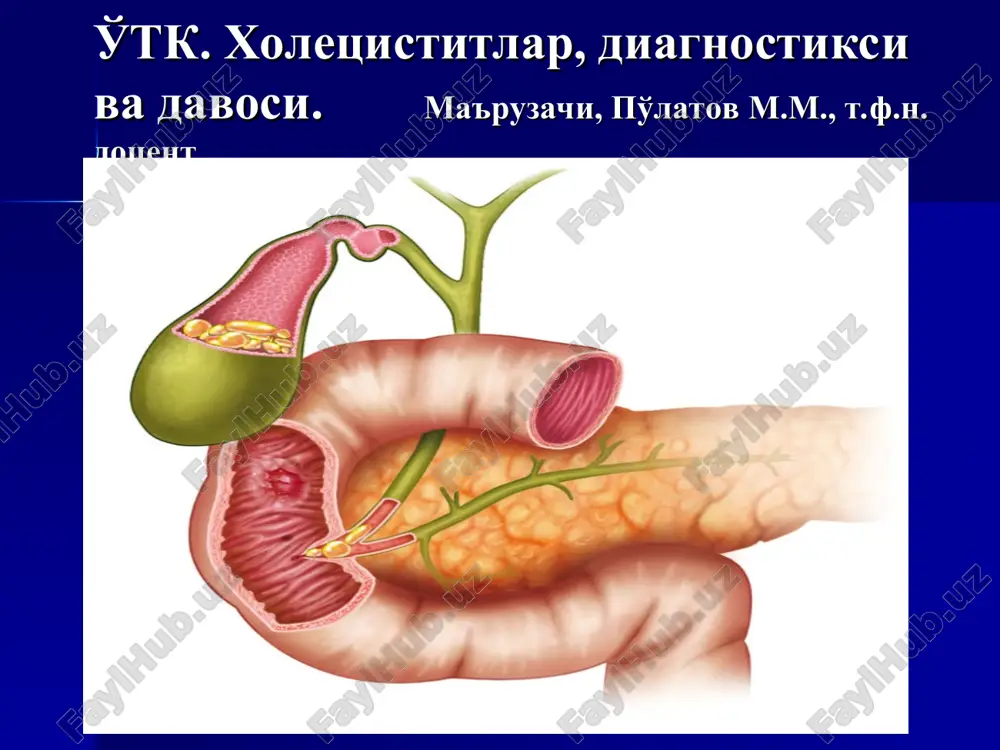 xoletsistitlar, diagnostika va davo — PPT