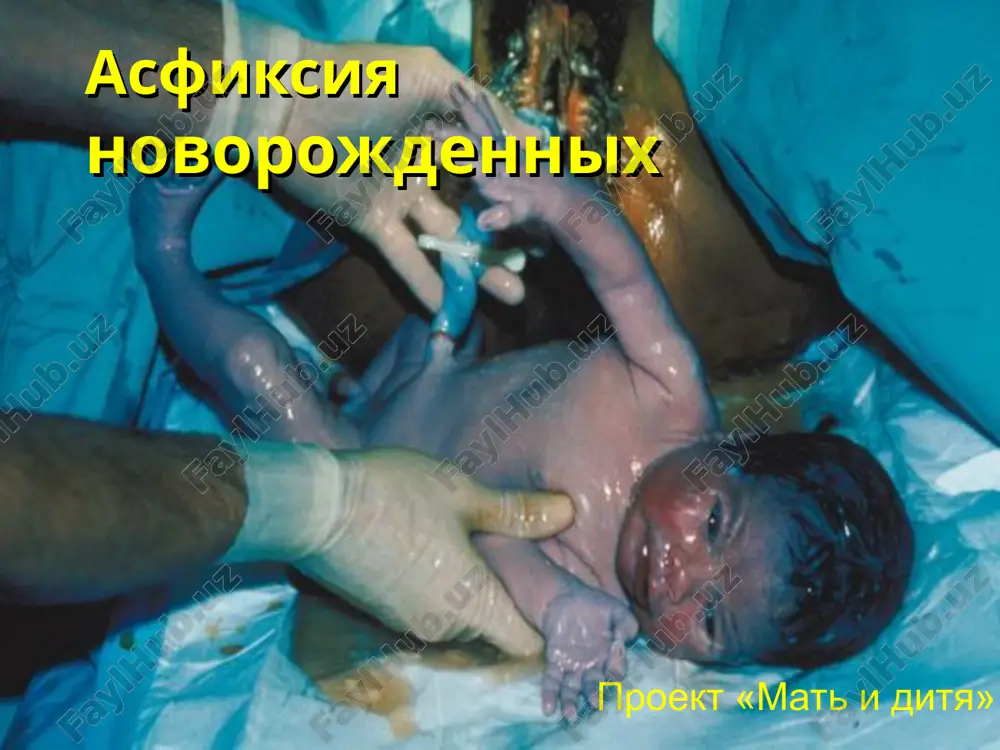 asfiksiyanovorojdennix — PPT