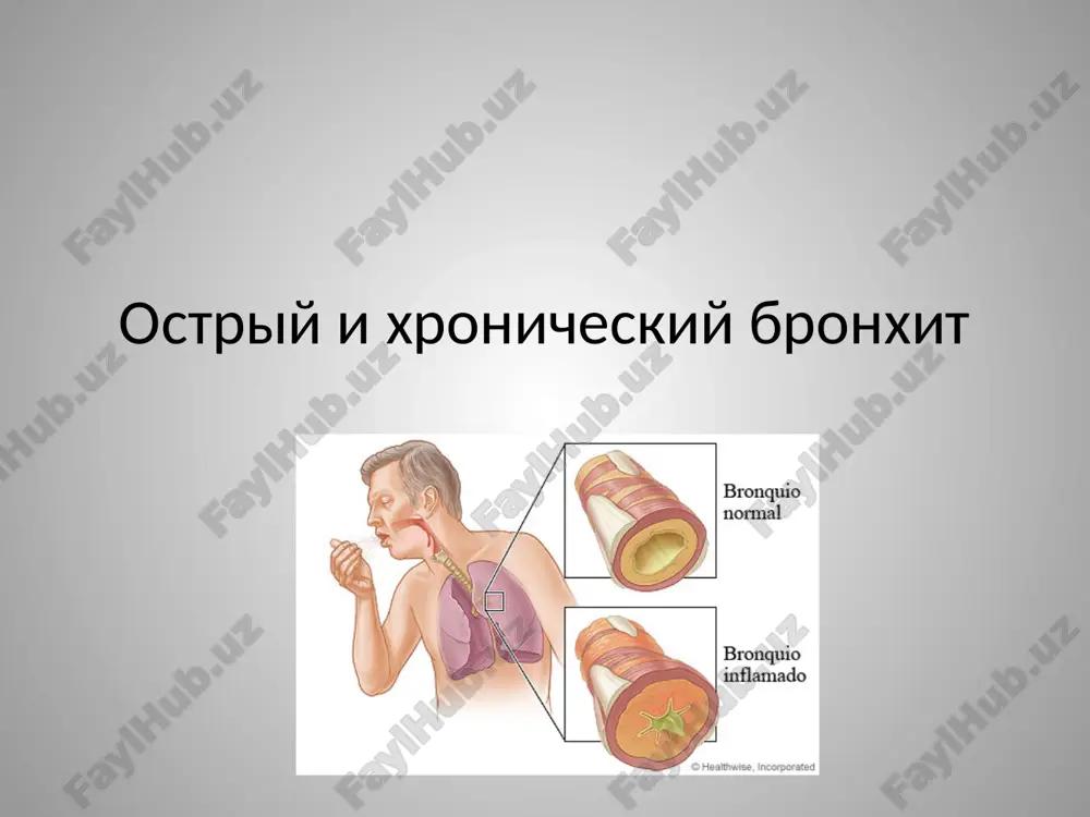 ostriy i xronicheskiy bronxit — PPTX