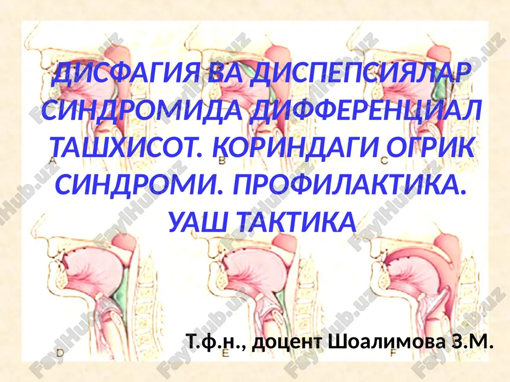 disfagiya va dispepsiyalar sindromida differentsial tashxisot. korindagi ogrik sindromi. profilaktika. uash taktika — PPT