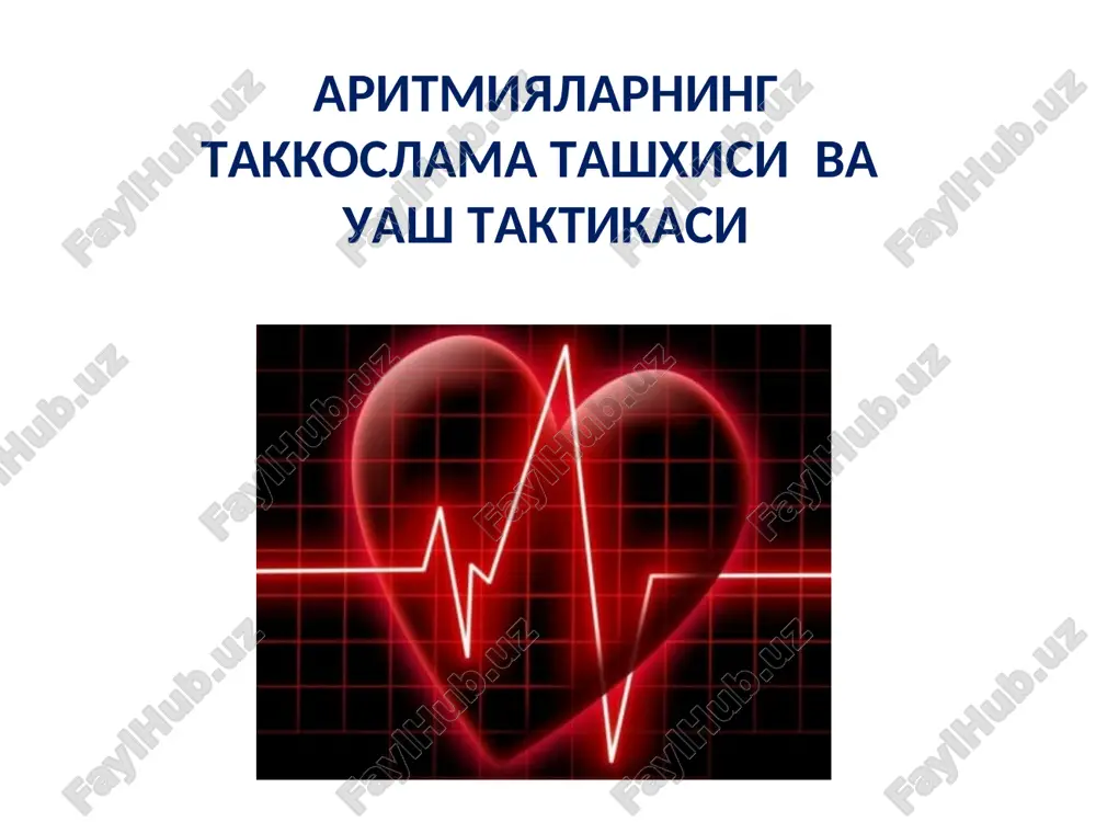 aritmialarni takkoslama tashhisi va uash taktikasi — PPT