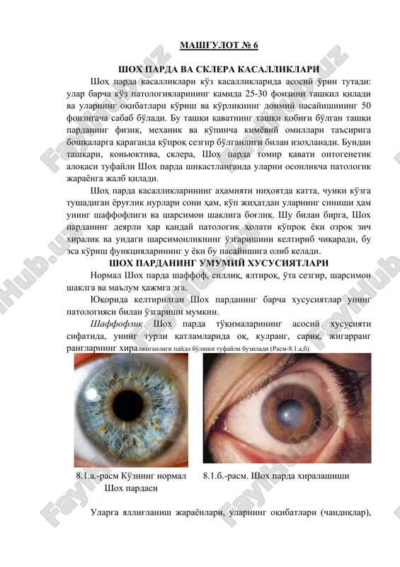shoh parda va sklera kasalliklari — DOC