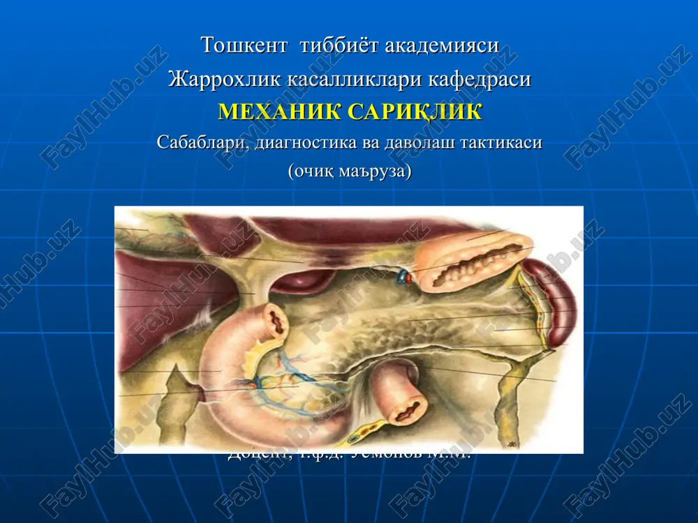mehanik sariqlik — PPT
