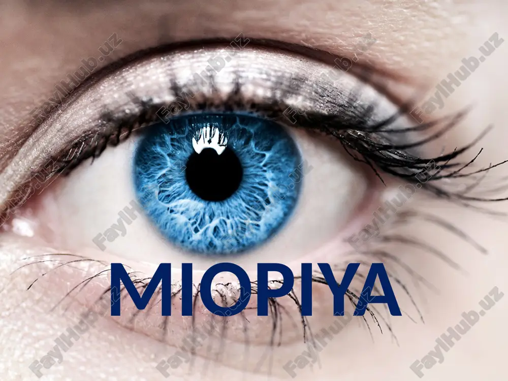 miyopiya — PPTX