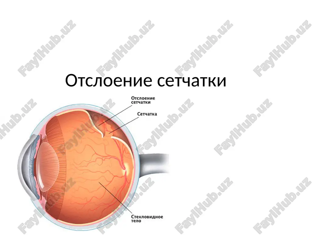 otsloenie setchatki — PPTX