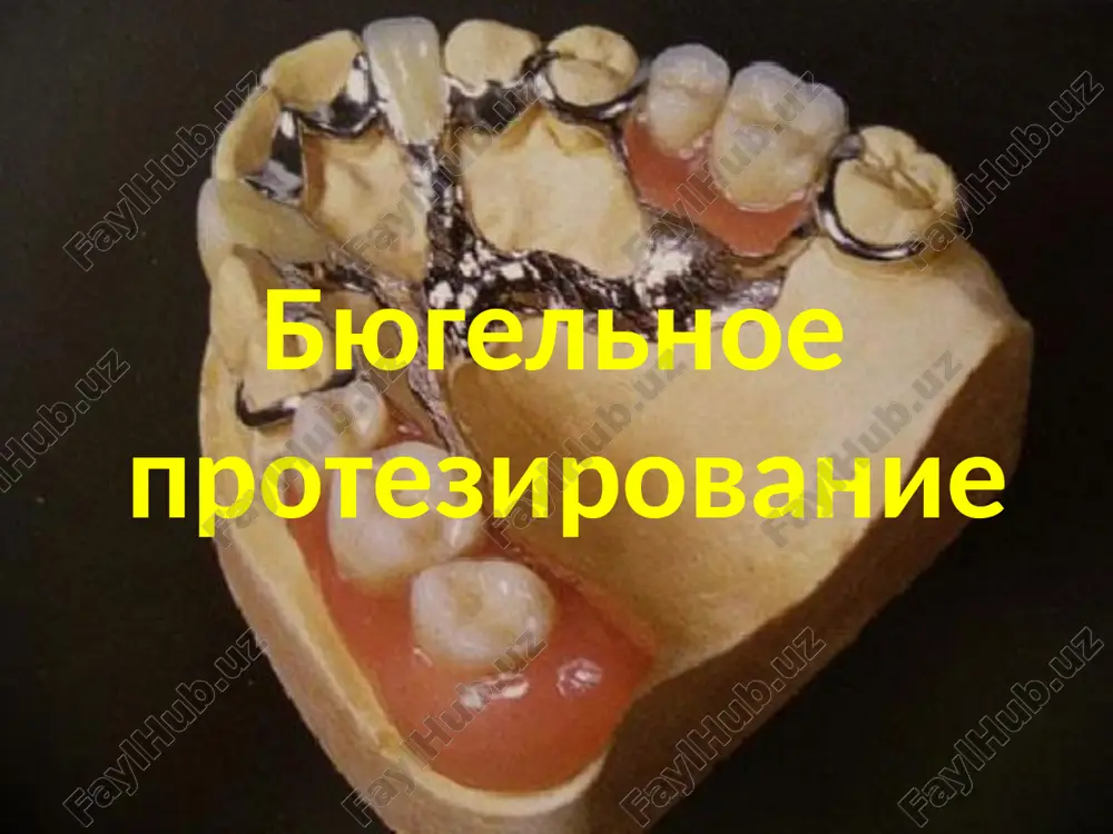 byugelnoe protezirovanie — PPTX
