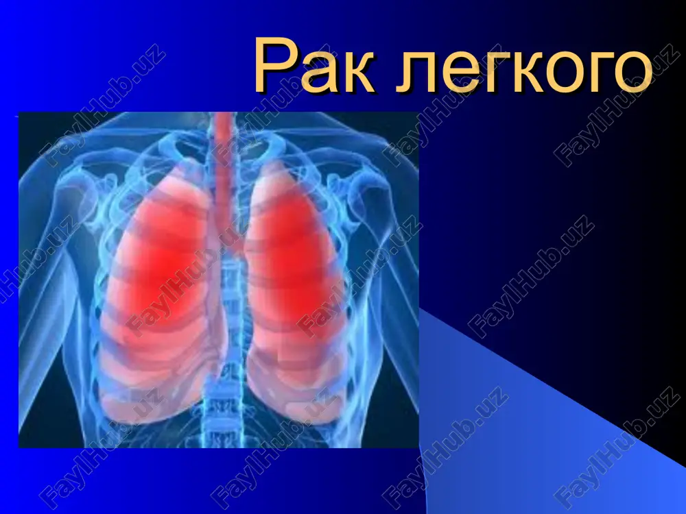 rak legkogo — PPT