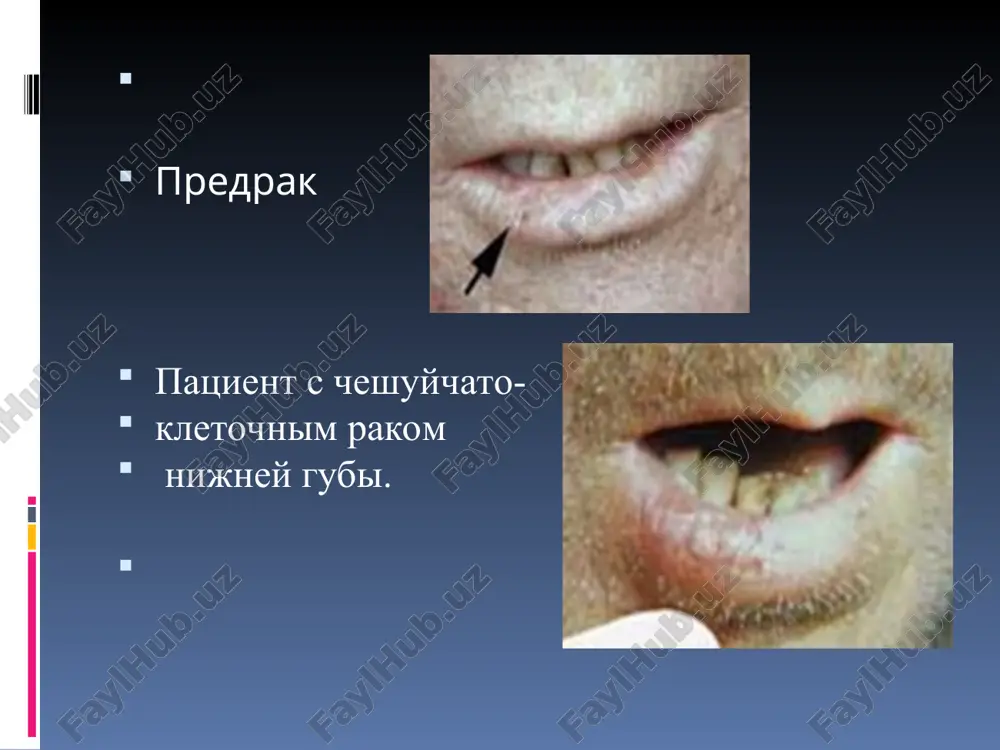 predrak — PPT