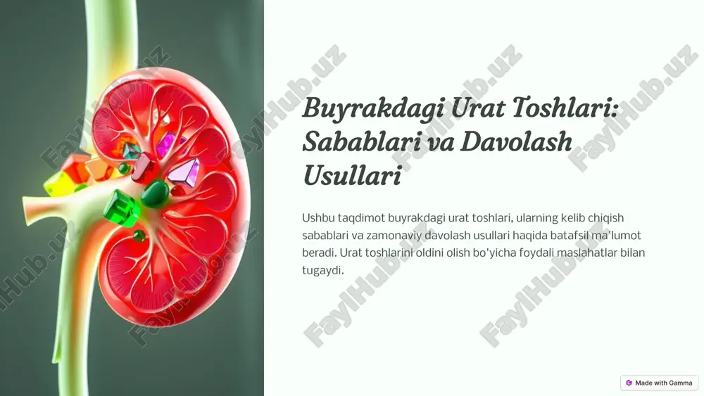 urat toshlari: sabablari va davolash usullari — PPTX
