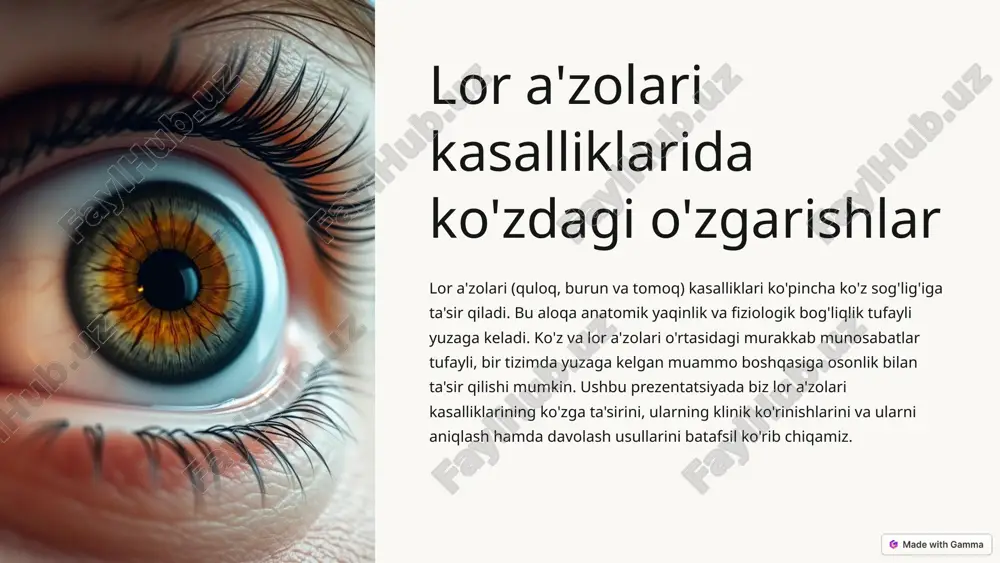 lor a'zolari kasalliklarida ko'zdagi o'zgarishlar — PPTX