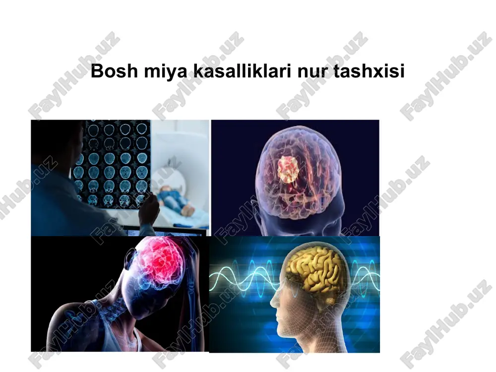 bosh miya kasalliklari nur tashxisi — PPTX