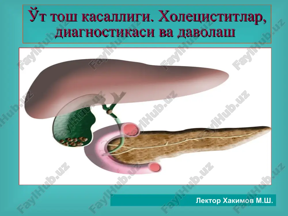 o't tosh kasalligi.xoletsistitlar, diagnostikasi va davolash — PPT