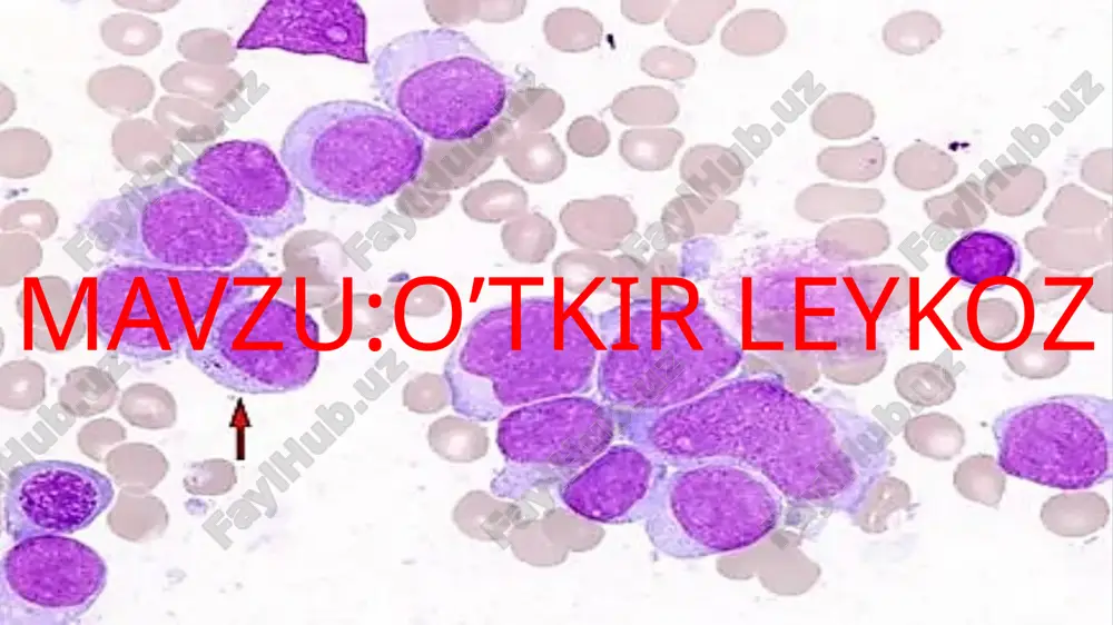 o’tkir leykoz — PPTX