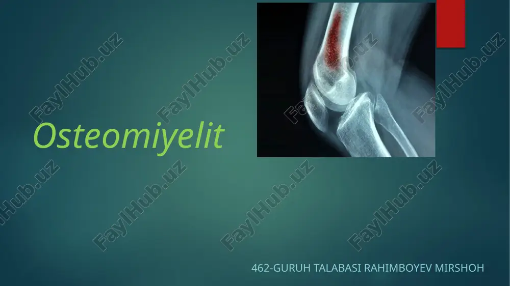 osteomiyelit — PPTX