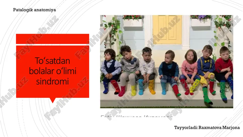 to’satdan bolalar o’limi sindromi — PDF