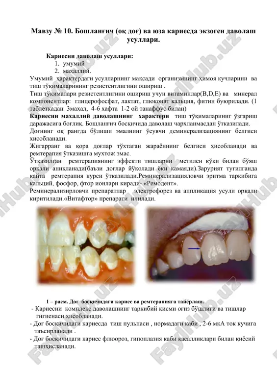 kariesni davolash usullari — DOCX