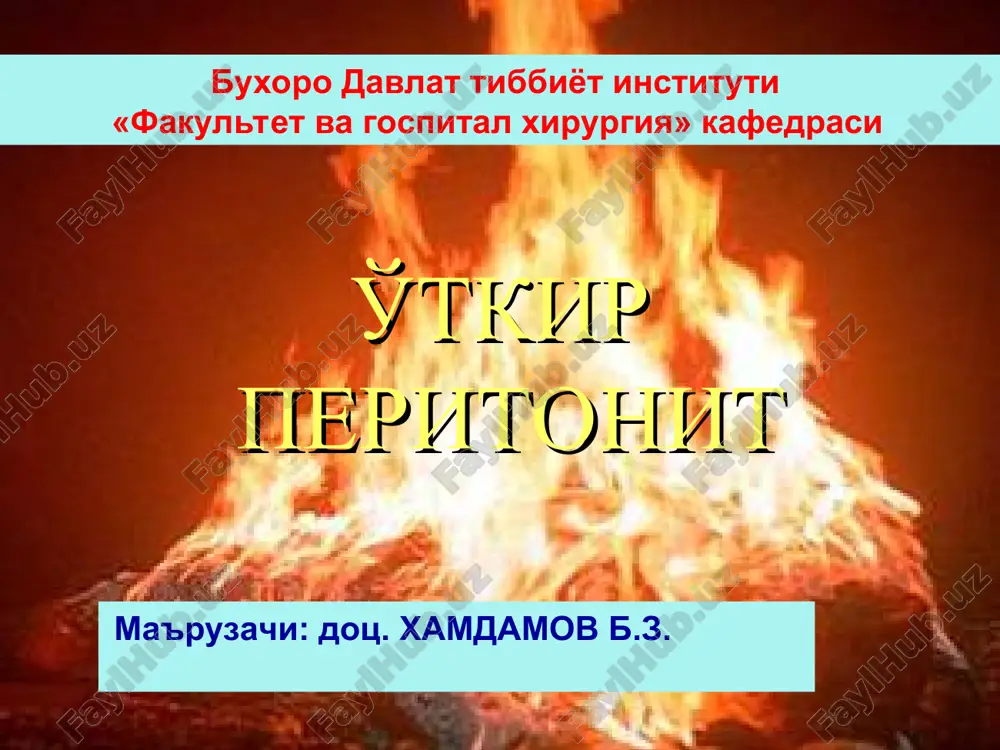 ўткир перитонит — PPT
