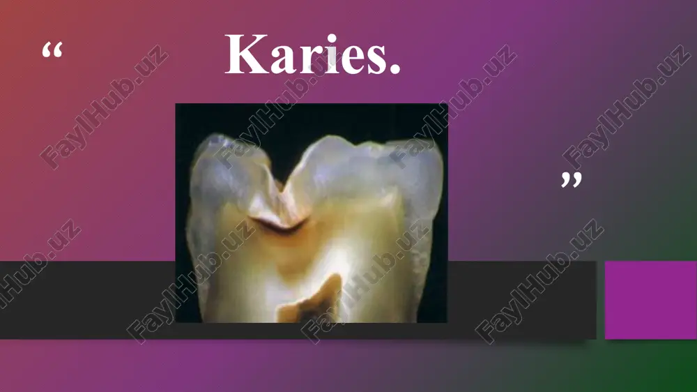 karies — PPTX