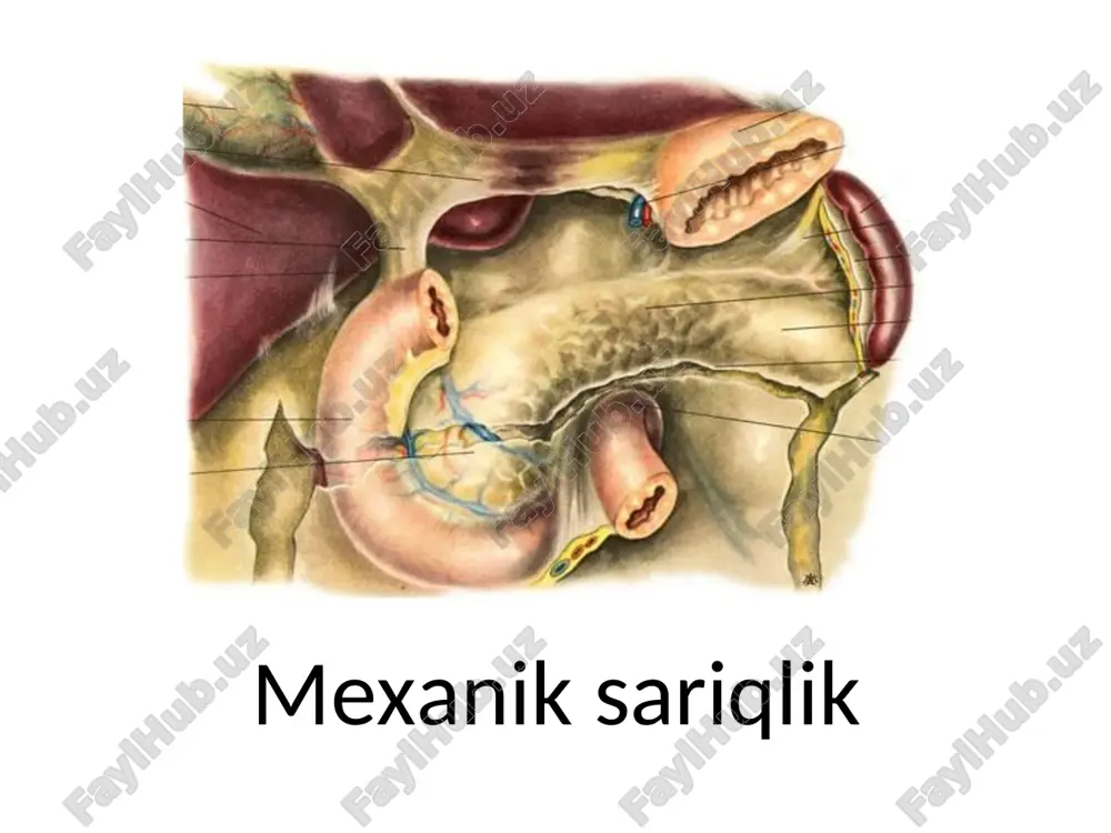 mexanik sariqlik — PPT