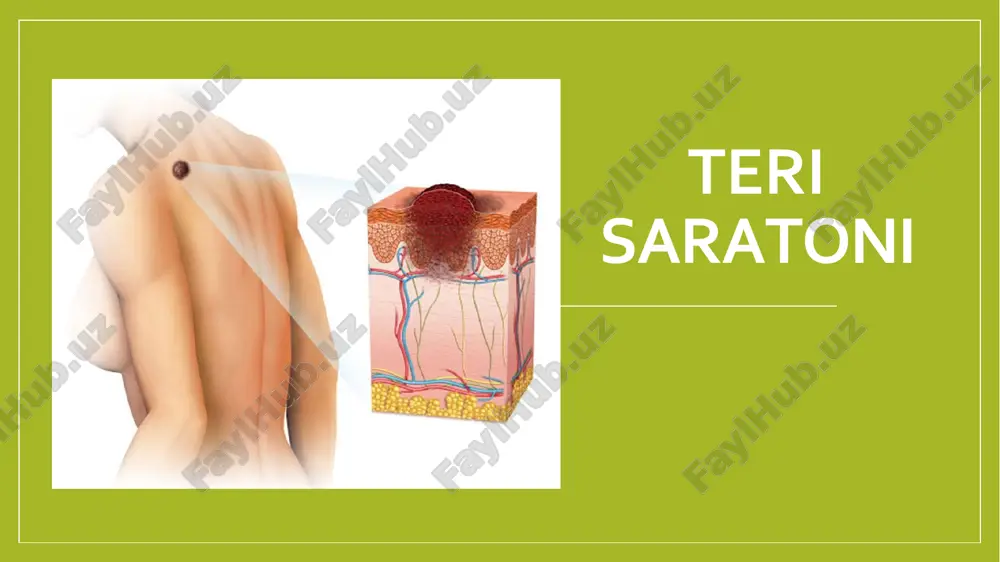 teri saratoni — PDF
