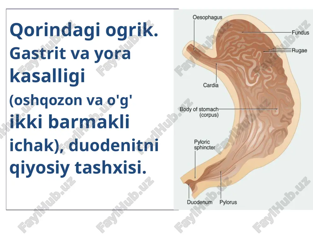 surunkali gastrit va o'q barmaqli ichak yara kasalligi — PDF