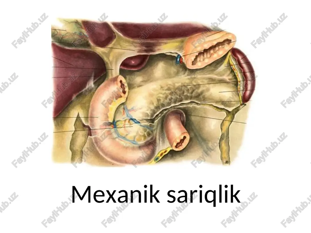 mexanik sariqlik — PPT