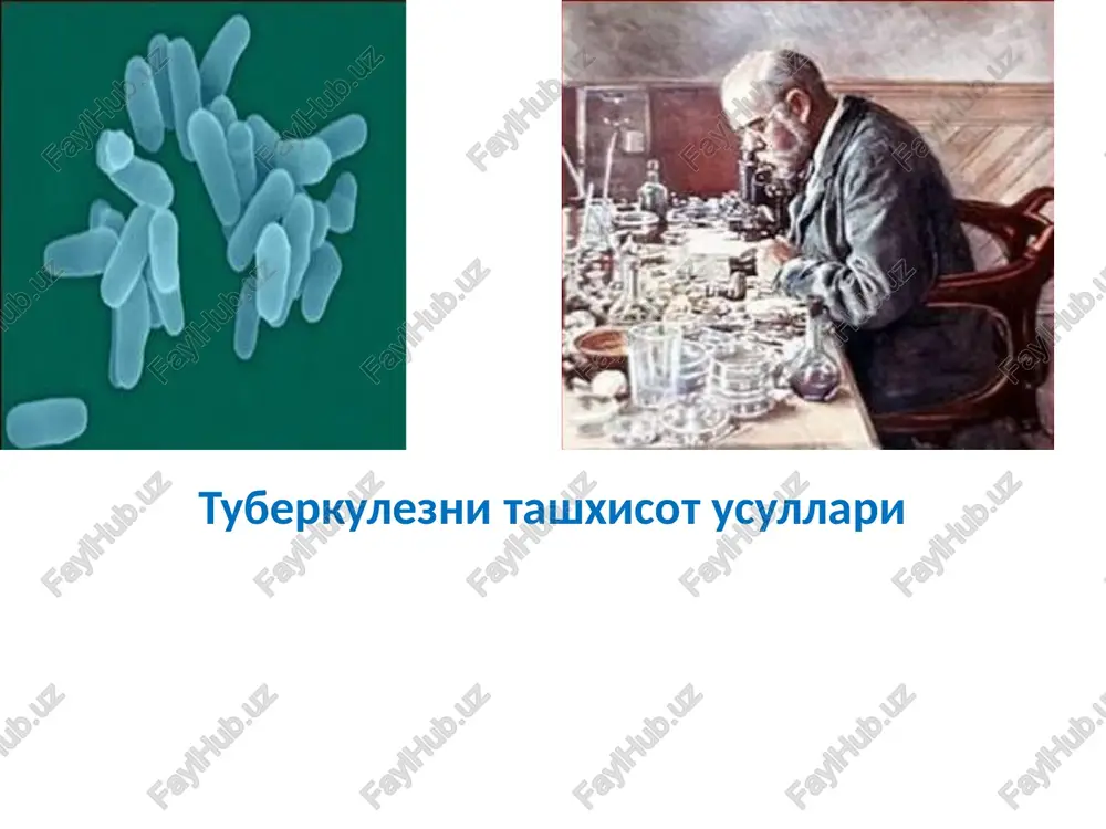 tuberkulezni tashhisot usullari — PPTX