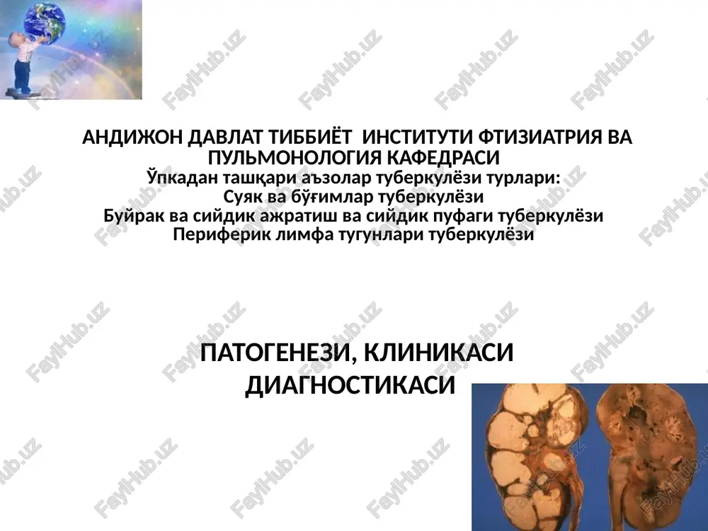 tuberkulyozi — PPTX