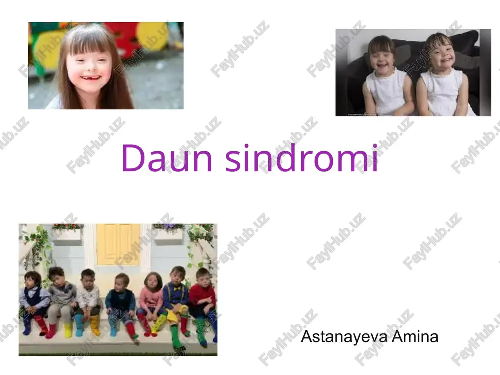 daun sindromi — PPTX