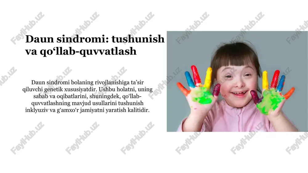 daun sindromi — PPTX