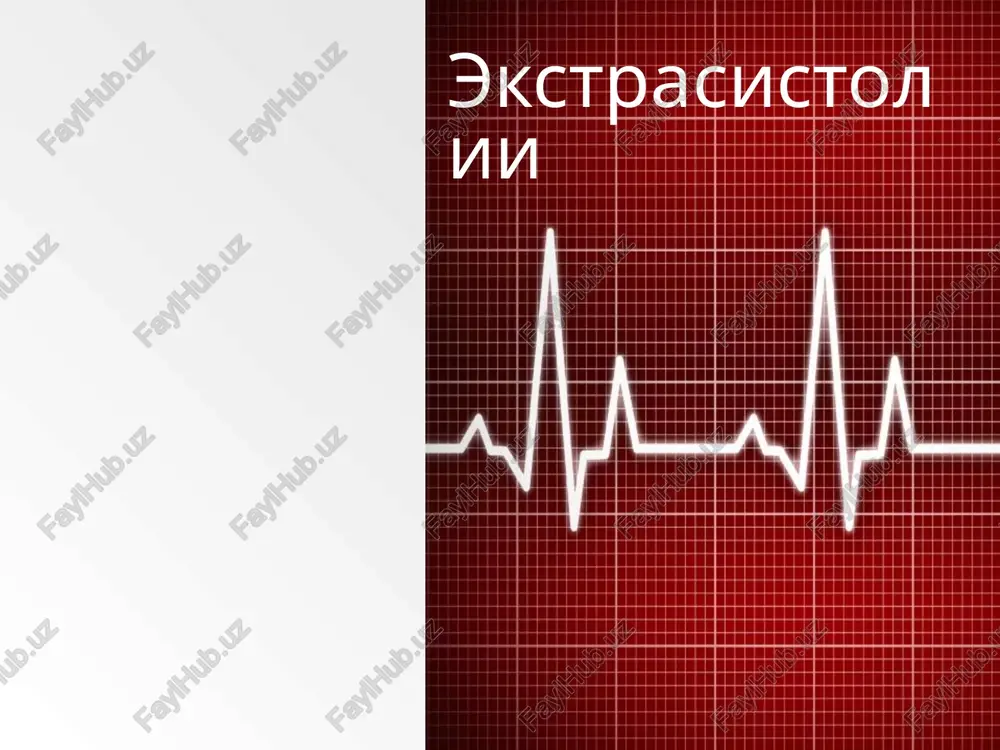 ekstrasistolii — PPT