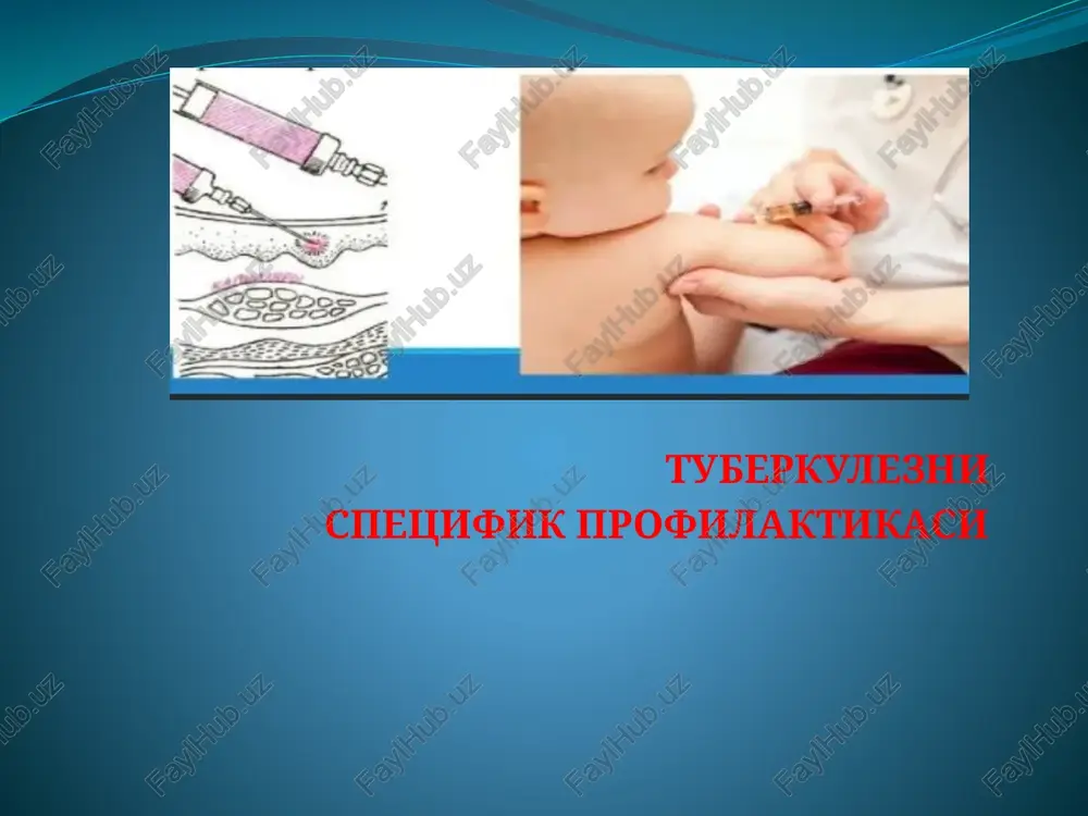 tuberkulezni spetsifik profilaktikasi — PPTX