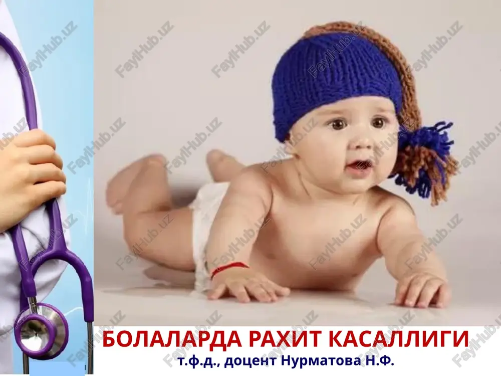 bolalarda raxit kasalligi — PPTX