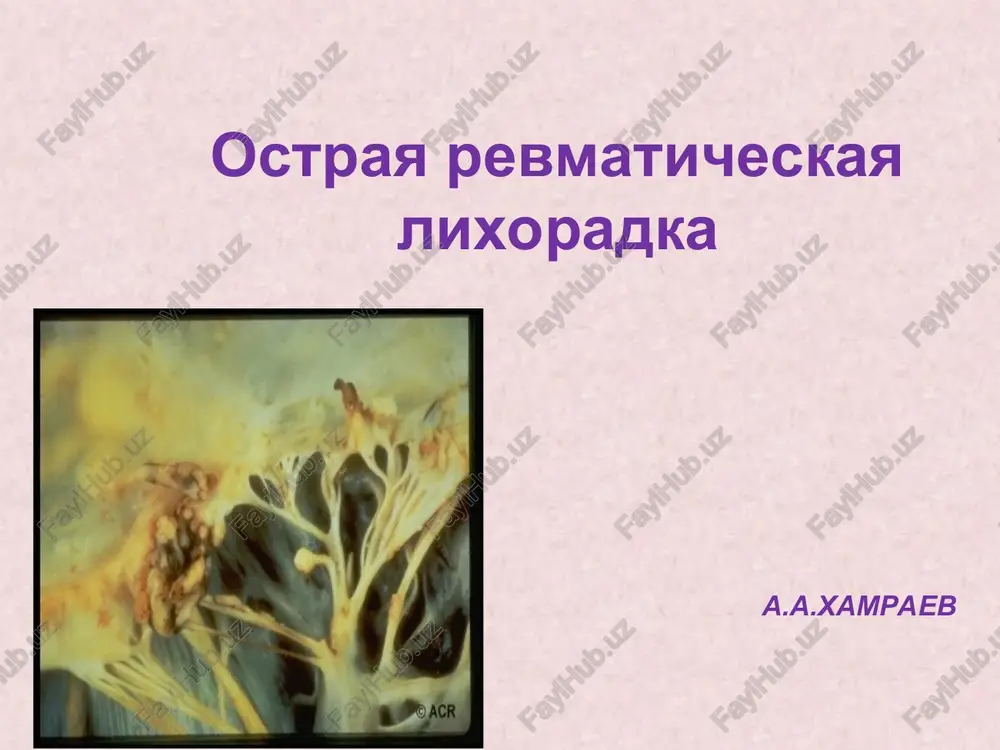 ostraya revmaticheskaya lixoradka — PPT