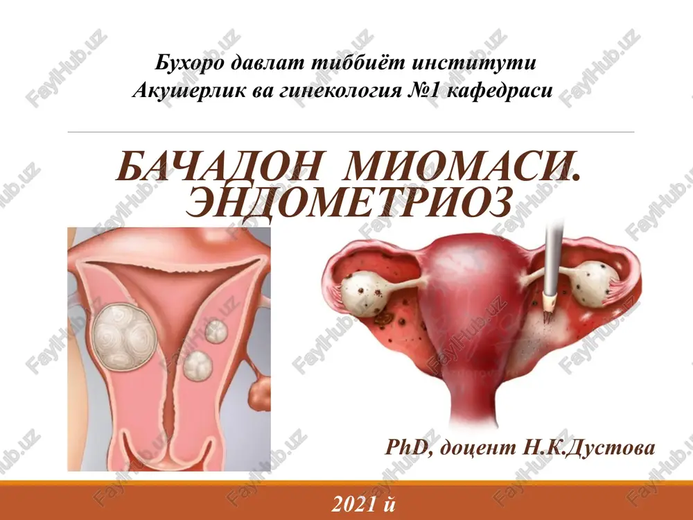 bachadon miomasi — PPT