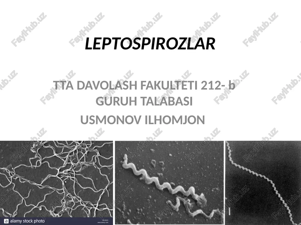 leptospirozlar — PPTX