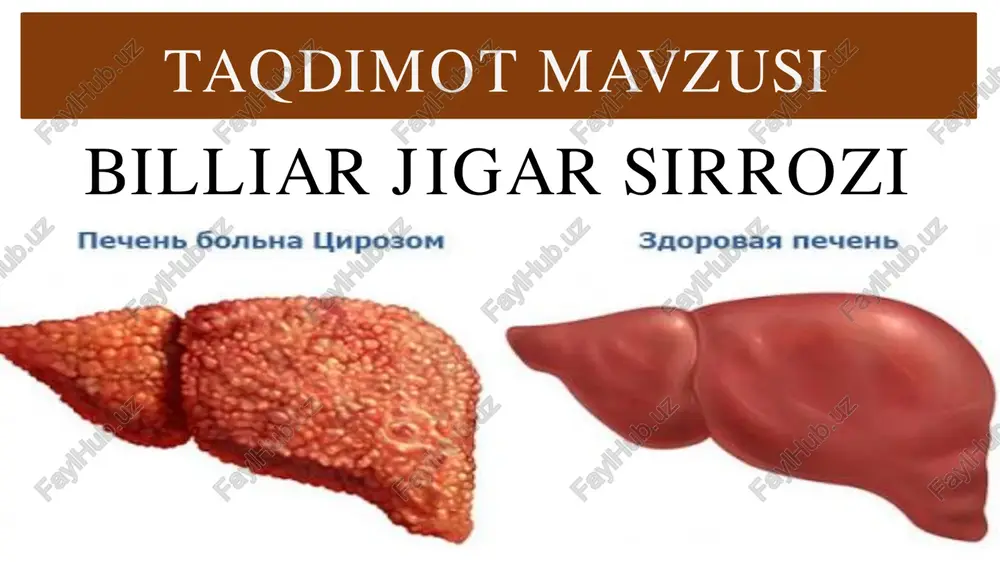 billiar jigar sirrozi — PDF