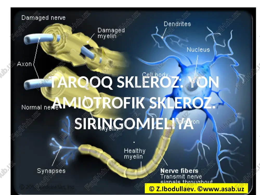 tarqoq skleroz — PPTX