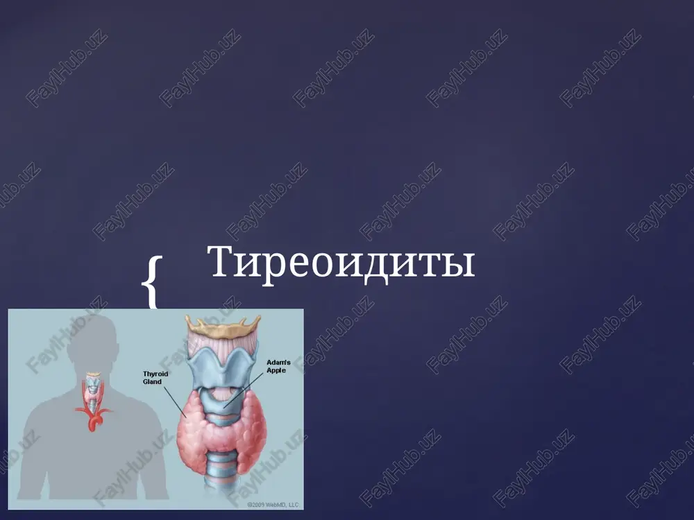 tireoiditi — PPTX