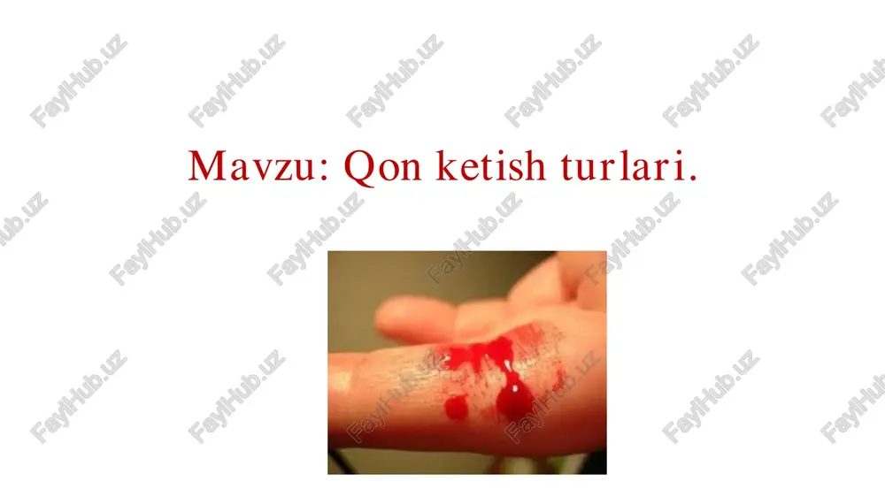 qon ketish turlari — PDF