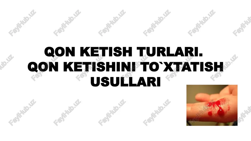 qon ketish turlari.qon ketishini to`xtatish usullari — PPTX