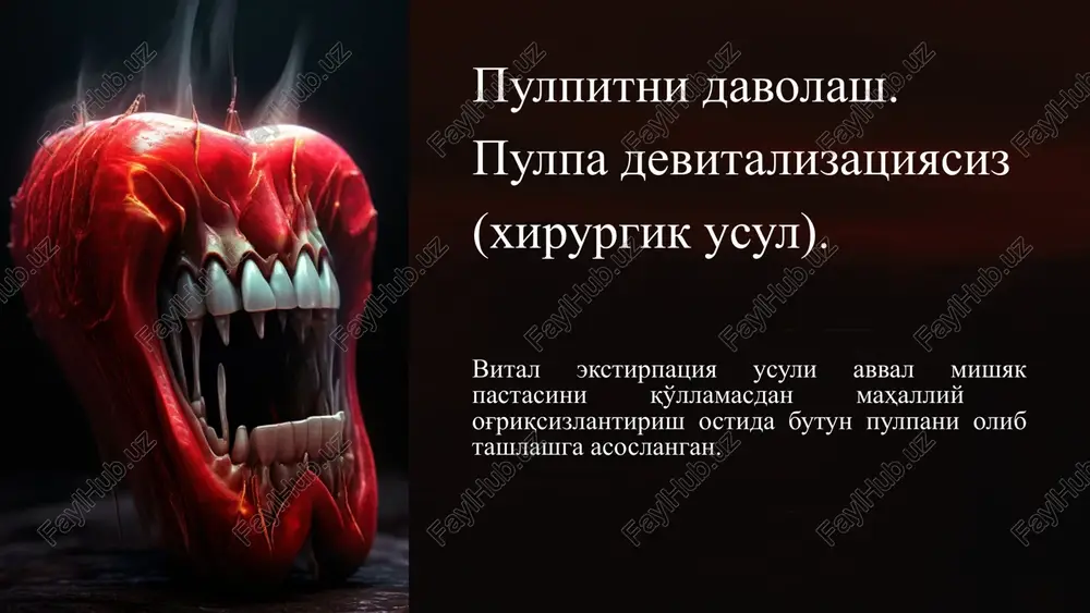pulpitni davolash (xirurgik usul) — PPTX