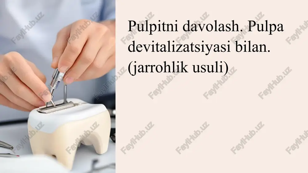 devitalizatsiyalovchi pasta — PPTX