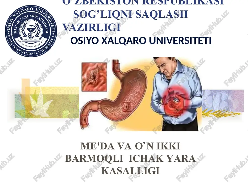 me'da vao`n ikkibarmoqli ichak yarakasalligi — PPT