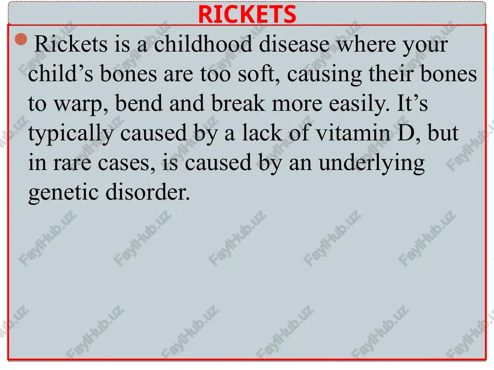 rickets — PPTX