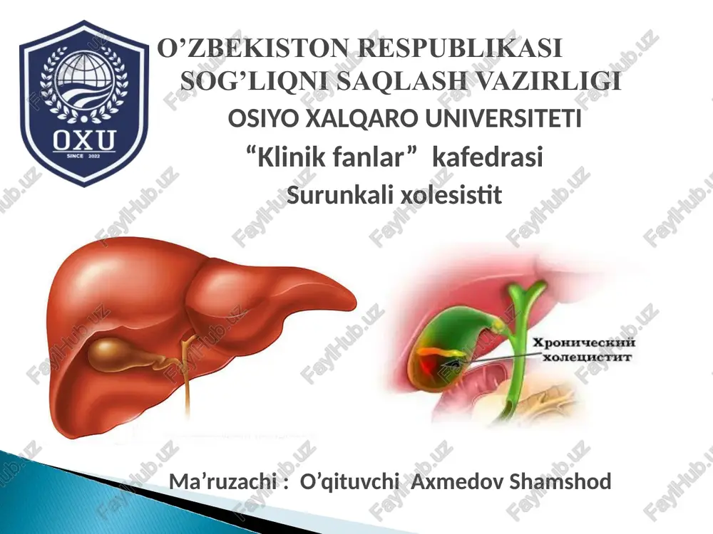 surunkali xolesistit — PPT
