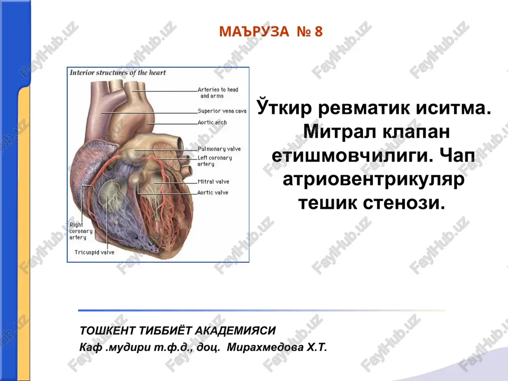 o'tkir revmatik isitma (o'ri) — PPT