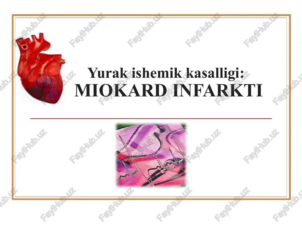 miokard infarkti — PPT