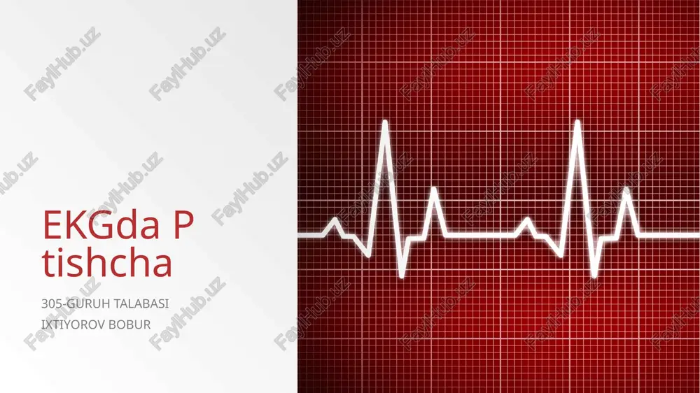ekgdaptishcha — PPTX