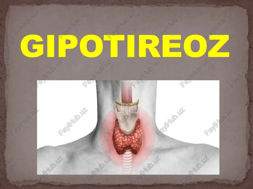 gipotireoz — PPTX